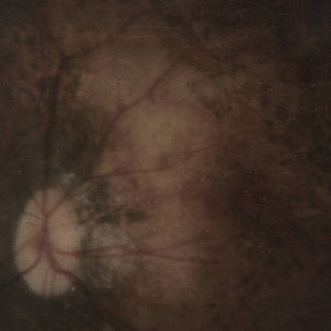 Artist: Pale Spektre - Title: Bereft of Xerotic Layers